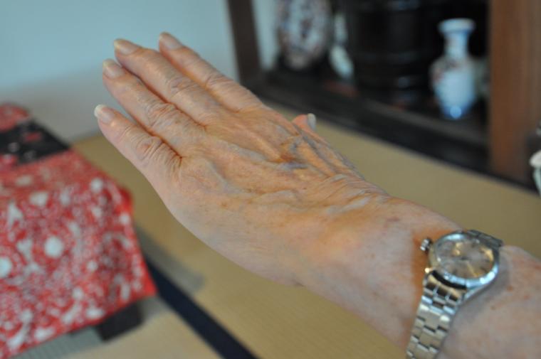 井手洋子会長の美しい手のひら